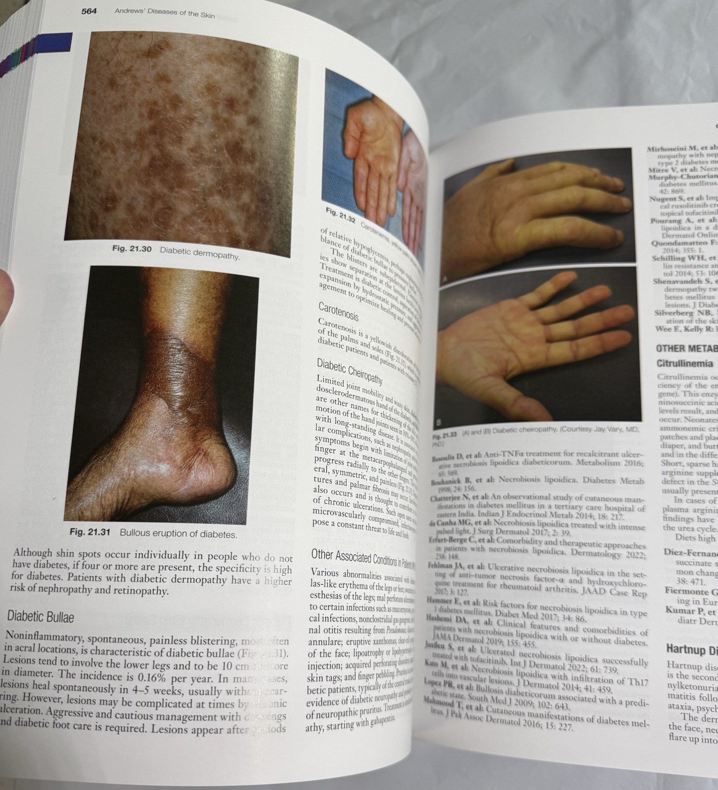 Andrews’ Diseases of the Skin / Fourteenth Edition 2025 Publish w/E-Print Code!