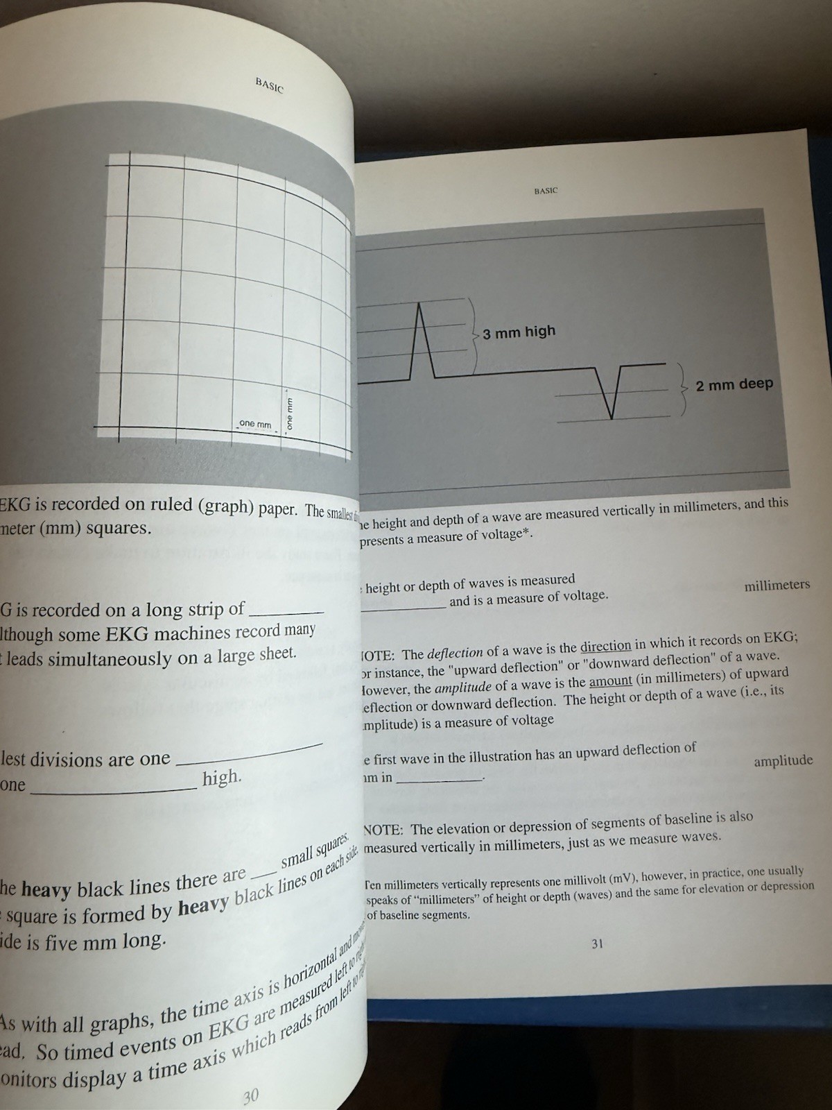 Rapid Interpretation of EKG’s Dale Dubin Edition V
