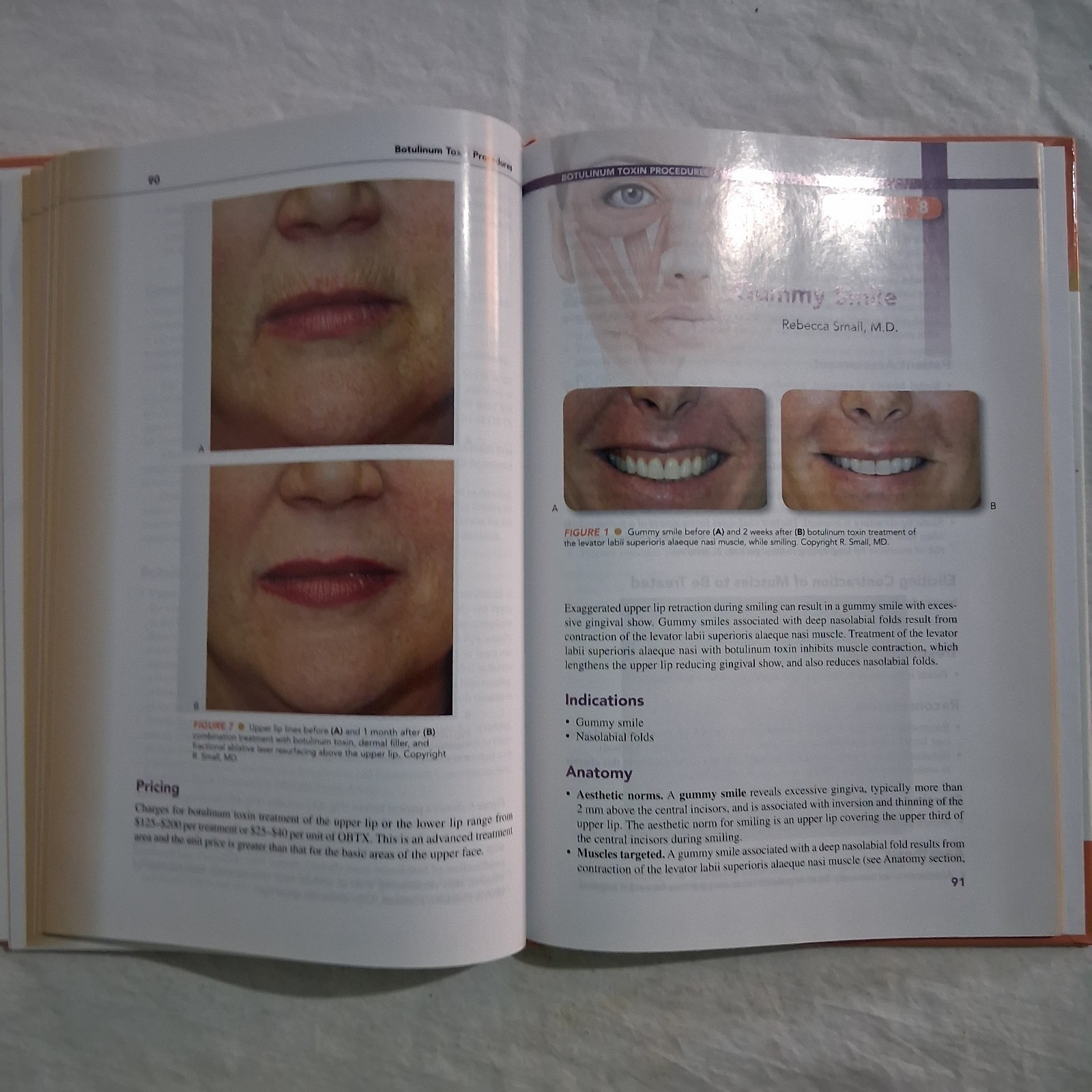 A Practical Guide to Botulinum Toxin Procedures Cosmetic HC
