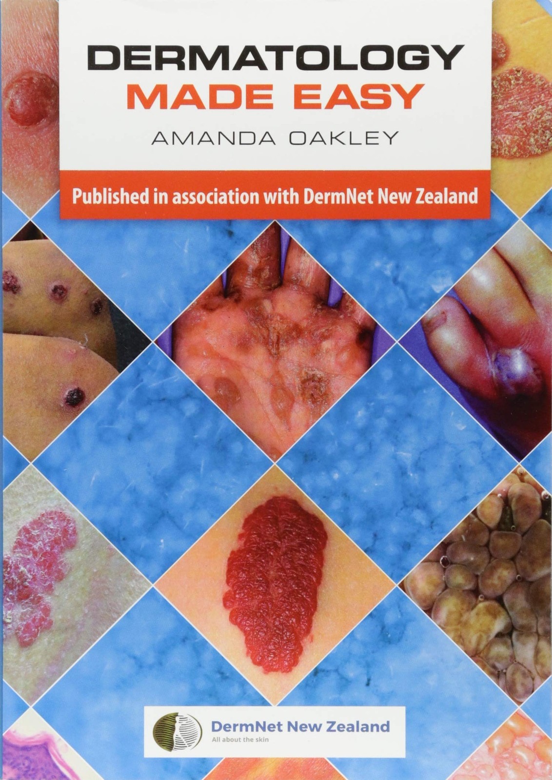 Dermatology Made Easy by Oakley