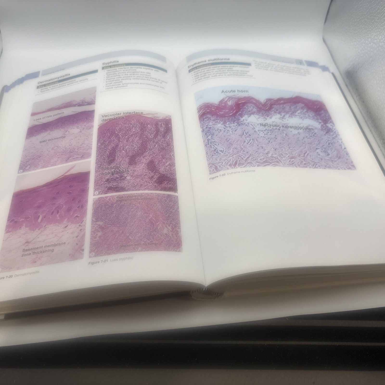 Dermatopathology- Requisites In Dermatology Dirk Elston Tammie Ferringer